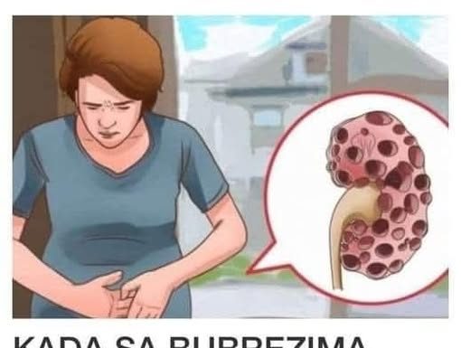 Ovo su znakovi da bubrezi otkazuju: Evo koji simptomi ukazuju zatajenje bubrega