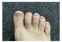 IMATE LI GLJIVICE I ŽUTE, ZADEBLJALE NOKTE: Samo namažite ovo ulje i riješit ćete problem preko noći