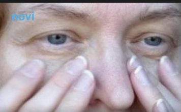 Bolest od koje strahuju milioni: Ovo su prvi simptomi