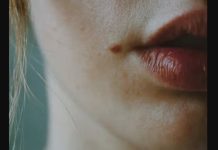 IMATE MLADEŽ IZ KOJEG RASTE DLAČICA – Evo šta to znači – Važno da znate