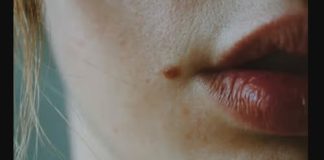 IMATE MLADEŽ IZ KOJEG RASTE DLAČICA – Evo šta to znači – Važno da znate