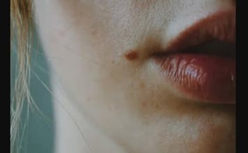 IMATE MLADEŽ IZ KOJEG RASTE DLAČICA – Evo šta to znači – Važno da znate