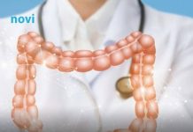 Gastroenterolozi otkrili koja vrsta mesa je najgora za vaša crijeva