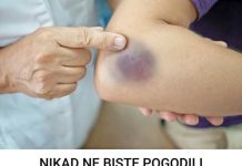 7 UZROKA MODRICA NA TIJELU, A NISU UDARCI: Evo šta može biti u pitanju