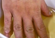 STAVLJALA JE RUKE U SIRĆE DVA PUTA SEDMIČNO: Evo šta se DESILO NJENOM tijelu, IZNENADIT ĆETE SE SIGURNO!