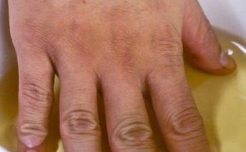 STAVLJALA JE RUKE U SIRĆE DVA PUTA SEDMIČNO: Evo šta se DESILO NJENOM tijelu, IZNENADIT ĆETE SE SIGURNO!