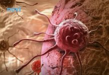 Ove dvije navike su glavni krivci za većinu karcinoma koji se mogu spriječiti, tvrde stručnjaci