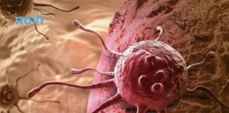 Ove dvije navike su glavni krivci za većinu karcinoma koji se mogu spriječiti, tvrde stručnjaci