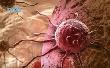 Ove dvije navike su glavni krivci za većinu karcinoma koji se mogu spriječiti, tvrde stručnjaci