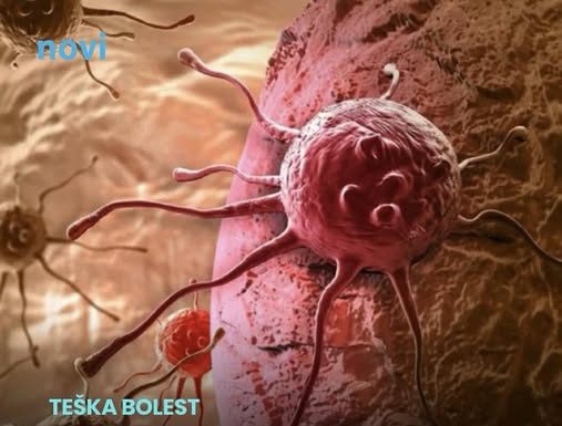 Ove dvije navike su glavni krivci za većinu karcinoma koji se mogu spriječiti, tvrde stručnjaci