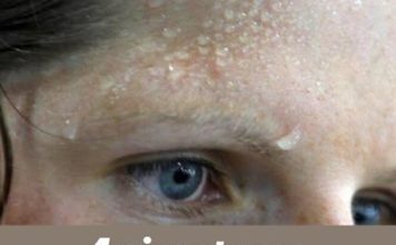 4 simptoma srčanog udara koji se obično pojavljuju nekoliko dana unaprijed