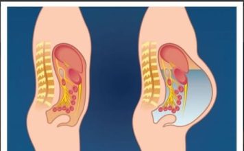 NEMOJTE OVO JESTI AKO ČUVATE LINIJU! Izaziva gasove i nadutost!
