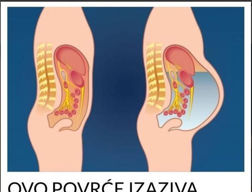 NEMOJTE OVO JESTI AKO ČUVATE LINIJU! Izaziva gasove i nadutost!