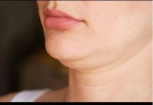 VEĆINA ŽENA IMA RUŽNI PODBRADAK, EVO KAKO DA GA SE RIJEŠITE: Nestaje za 72 sata, ŽENE SEKUNU U OVAJ TRIK