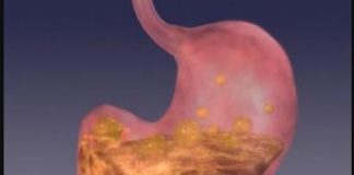 BOLJI LIJEK ZA GASTRITIS OD OVOG NE POSTOJI: Bolovi u želucu će nestati već nakon prve čaše