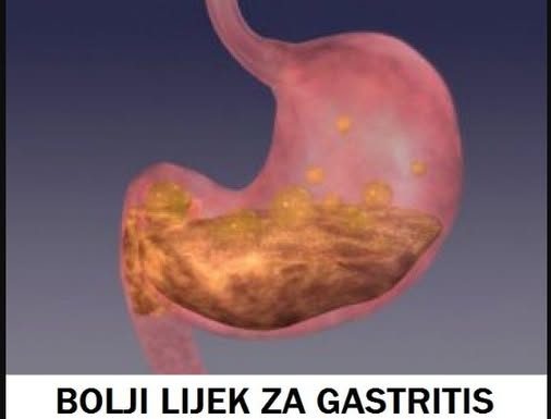 BOLJI LIJEK ZA GASTRITIS OD OVOG NE POSTOJI: Bolovi u želucu će nestati već nakon prve čaše