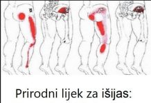 Prirodni lijek za išijas: Recept od bijelog luka koji uklanja bol u leđima i nogama