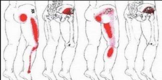 Prirodni lijek za išijas: Recept od bijelog luka koji uklanja bol u leđima i nogama