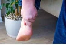 3 ZNAKA VISOKOG HOLESTEROLA: Odmah pogledajte vaše ruke i noge