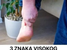 3 ZNAKA VISOKOG HOLESTEROLA: Odmah pogledajte vaše ruke i noge