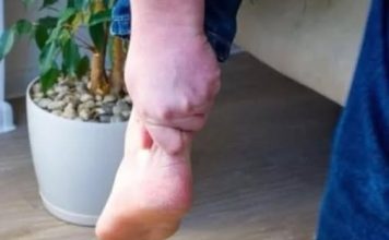 3 ZNAKA VISOKOG HOLESTEROLA: Odmah pogledajte vaše ruke i noge