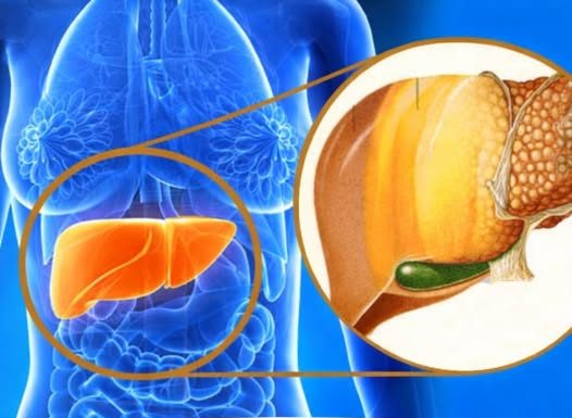 Sve veći broj ljudi ima masnu jetru: Uzrok nije alkohol, već jedan sastojak za koji svi misle da je zdrav