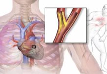 Probada vas u grudima, ili vam preskače srce: Izliječite sve probleme sa srcem, čak i anginu pektoris! – Probajte ovo odmah!