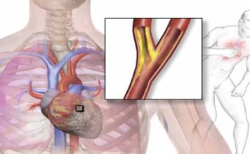 Probada vas u grudima, ili vam preskače srce: Izliječite sve probleme sa srcem, čak i anginu pektoris! – Probajte ovo odmah!