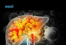 Masnu jetru ima i svaka 5. mršava osoba: Ovo su podmukli simptomi