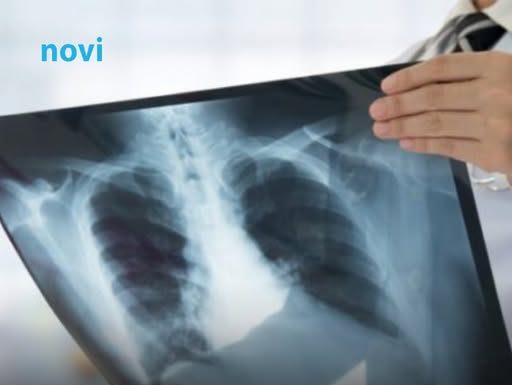 Spas za pluća, ova 3 začina izbacuju sve otrove iz disajnih puteva