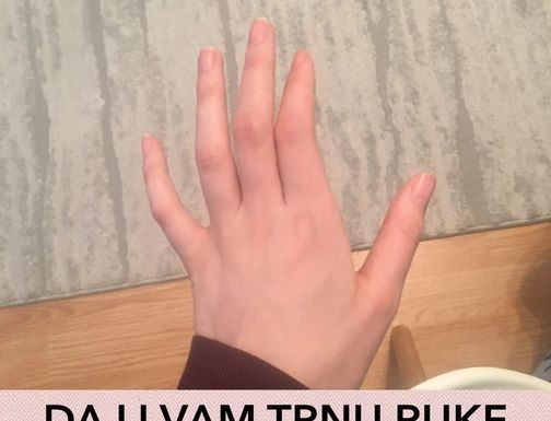 OBAVEZNO OBRATITE PAŽNJU: Ako vam trnu prsti, to može da znači nekoliko stvari, a ovo je uzrok