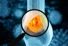 Tihi simptomi raka kostiju: Kakav bol i u kom delu tela može da bude alarm upozorenja