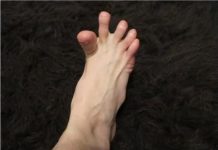 DA LI VAM SE GRČE PRSTI NA STOPALIMA? Evo Na Šta Vas To Upozorava, Može Biti Znak Većih Problema