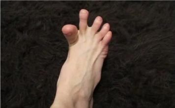 DA LI VAM SE GRČE PRSTI NA STOPALIMA? Evo Na Šta Vas To Upozorava, Može Biti Znak Većih Problema
