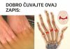 Bolovi u zglobovima ruku i nogu simptomi i lečenje