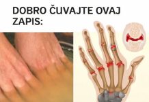 Bolovi u zglobovima ruku i nogu simptomi i lečenje