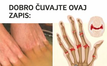 Bolovi u zglobovima ruku i nogu simptomi i lečenje