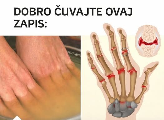 Bolovi u zglobovima ruku i nogu simptomi i lečenje