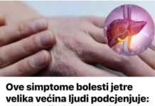 Ove simptome bolesti jetre velika većina ljudi podcjenjuje: Ako primijetite ovu pojavu na svojoj koži, NEMATE PUNO VREMENA