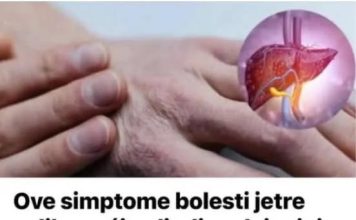 Ove simptome bolesti jetre velika većina ljudi podcjenjuje: Ako primijetite ovu pojavu na svojoj koži, NEMATE PUNO VREMENA