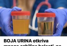 BOJA URINA otkriva mnoge ozbiljne bolesti, pa čak i one NAJTEŽE – Ovo je RAZLOG mutne mokraće!