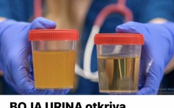 BOJA URINA otkriva mnoge ozbiljne bolesti, pa čak i one NAJTEŽE – Ovo je RAZLOG mutne mokraće!