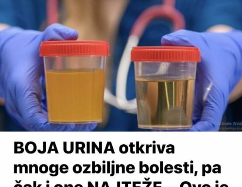 BOJA URINA otkriva mnoge ozbiljne bolesti, pa čak i one NAJTEŽE – Ovo je RAZLOG mutne mokraće!