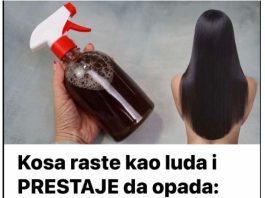 Kosa raste kao luda i PRESTAJE da opada: ŽIVA VODA za kosu, efekat će vas oduševiti!