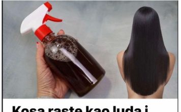 Kosa raste kao luda i PRESTAJE da opada: ŽIVA VODA za kosu, efekat će vas oduševiti!