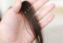 Evo šta kosa otkriva o našem zdravlju: Bolesna štitnjača ili anemija…