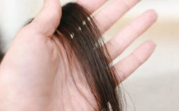 Evo šta kosa otkriva o našem zdravlju: Bolesna štitnjača ili anemija…