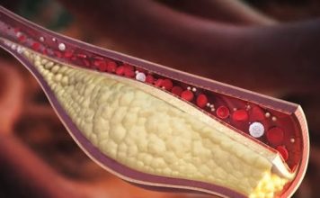 Ovo je najzdraviji prirodni napitak: Zbogom lošem holesterolu i začepljenim arterijama! (RECEPT)