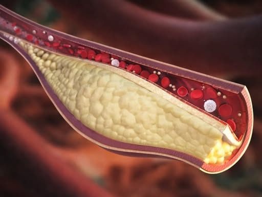 Ovo je najzdraviji prirodni napitak: Zbogom lošem holesterolu i začepljenim arterijama! (RECEPT)