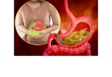 10 namirnica koje izazivaju gasove i nadutost: Pasulj jeste glavni, ali ne i jedini krivac